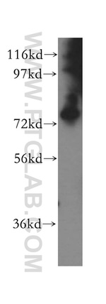 PARN Antibody in Western Blot (WB)