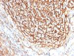 CD21 Antibody in Immunohistochemistry (Paraffin) (IHC (P))