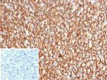 CD21 Antibody in Immunohistochemistry (Paraffin) (IHC (P))