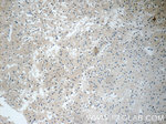 DARS2 Antibody in Immunohistochemistry (Paraffin) (IHC (P))