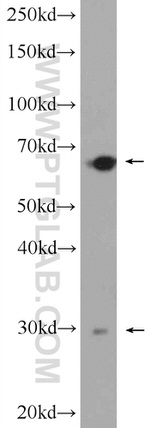 AACS Antibody in Western Blot (WB)