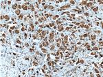 Pirh2 Antibody in Immunohistochemistry (Paraffin) (IHC (P))