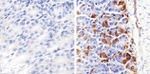 beta Catenin Antibody in Immunohistochemistry (Paraffin) (IHC (P))