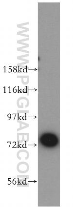 JAKMIP1 Antibody in Western Blot (WB)