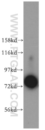 JAKMIP1 Antibody in Western Blot (WB)