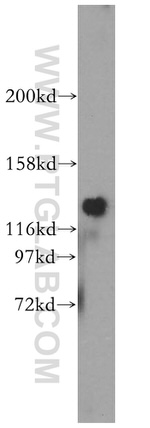 NCAM2 Antibody in Western Blot (WB)