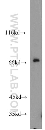 SORBS1 Antibody in Western Blot (WB)