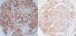 Bcl-2 Antibody in Immunohistochemistry (Paraffin) (IHC (P))