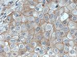 PKC iota Antibody in Immunohistochemistry (Paraffin) (IHC (P))