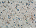 CX3CR1 Antibody in Immunohistochemistry (Paraffin) (IHC (P))