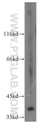 MEK3 Antibody in Western Blot (WB)