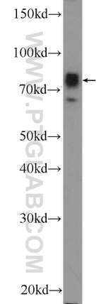 NR1D2 Antibody in Western Blot (WB)