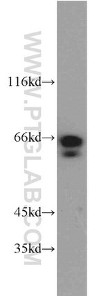 SODD/BAG4 Antibody in Western Blot (WB)