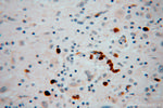 KIF3A Antibody in Immunohistochemistry (Paraffin) (IHC (P))