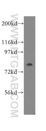 KIF3A Antibody in Western Blot (WB)