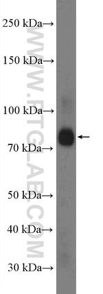 KIF3A Antibody in Western Blot (WB)