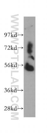 WARS2 Antibody in Western Blot (WB)