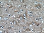 FAM19A5 Antibody in Immunohistochemistry (Paraffin) (IHC (P))