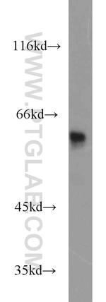 KPNA5 Antibody in Western Blot (WB)