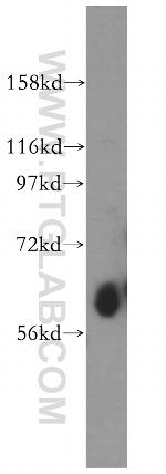 ZnT7 Antibody in Western Blot (WB)