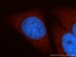 HSPA1L Antibody in Immunocytochemistry (ICC/IF)