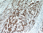 HSPA1L Antibody in Immunohistochemistry (Paraffin) (IHC (P))