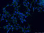 ALS2 Antibody in Immunocytochemistry (ICC/IF)