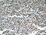 OLIG2 Antibody in Immunohistochemistry (Paraffin) (IHC (P))