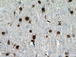 OLIG2 Antibody in Immunohistochemistry (Paraffin) (IHC (P))