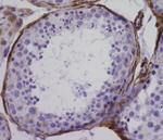 Desmin Antibody in Immunohistochemistry (Paraffin) (IHC (P))