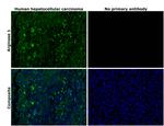 Arginase 1 Antibody in Immunohistochemistry (Paraffin) (IHC (P))