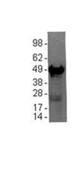 GFAP Monoclonal Antibody (GA5) (14-9892-82)