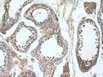 PPP3R2 Antibody in Immunohistochemistry (Paraffin) (IHC (P))