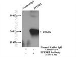 PPP3R2 Antibody in Immunoprecipitation (IP)