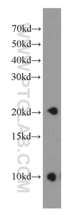 PPP3R2 Antibody in Western Blot (WB)