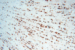 ELAVL2 Antibody in Immunohistochemistry (Paraffin) (IHC (P))