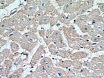 SOCS3 Antibody in Immunohistochemistry (Paraffin) (IHC (P))