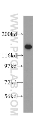 CCP1 Antibody in Western Blot (WB)