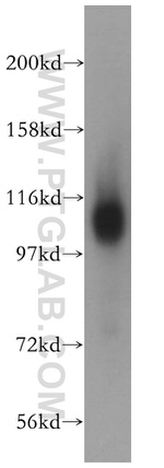 Nicastrin Antibody in Western Blot (WB)