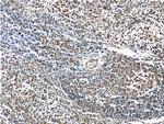 UBE2R2 Antibody in Immunohistochemistry (Paraffin) (IHC (P))