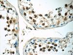 RNF8 Antibody in Immunohistochemistry (Paraffin) (IHC (P))