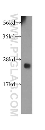 UBE2S Antibody in Western Blot (WB)