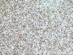 TPPII Antibody in Immunohistochemistry (Paraffin) (IHC (P))