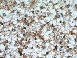 TPPII Antibody in Immunohistochemistry (Paraffin) (IHC (P))