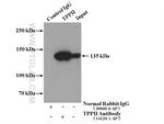 TPPII Antibody in Immunoprecipitation (IP)