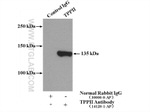 TPPII Antibody in Immunoprecipitation (IP)