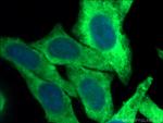 RPS3A Antibody in Immunocytochemistry (ICC/IF)