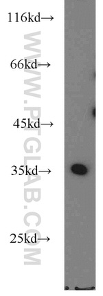 RPS3A Antibody in Western Blot (WB)