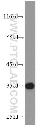 RPS3A Antibody in Western Blot (WB)