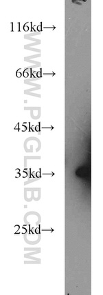 RPS3A Antibody in Western Blot (WB)